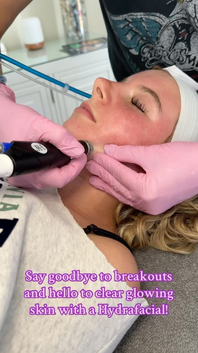 ✨ Glowing skin is just one Hydrafacial away! Book your session with our amazing esthetician, Allie, to get that fresh, dewy glow. Your skin will thank you! 💧 #hydrafacialglow #glowup 

DM or call 980-949-6544 to book!📲